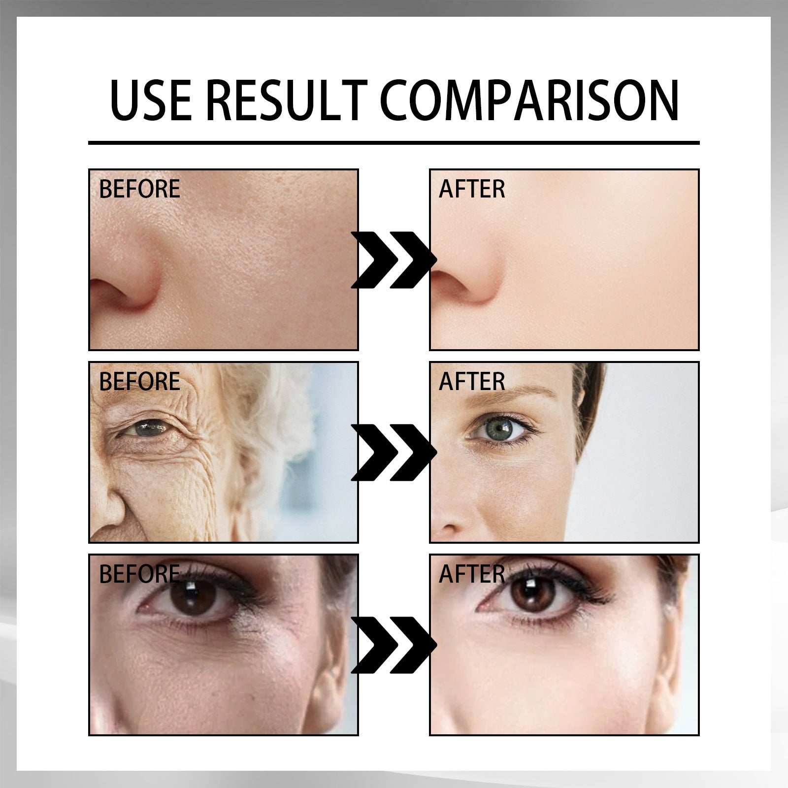 Snail Cream Fading Wrinkle French Lines Replenishment Firming Skin Anti-Aging Snail Cream Fading Wrinkle French Lines Replenishment Firming Skin Anti-Aging